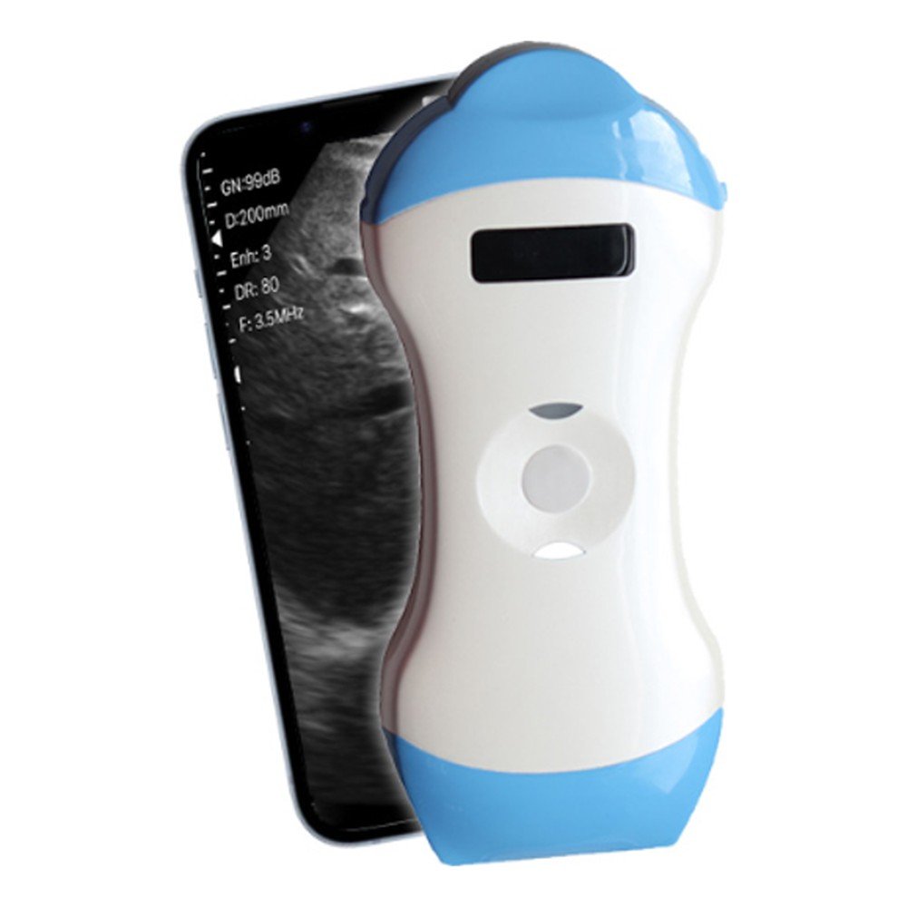 Ultrasonido portátil inalámbrico XProbe