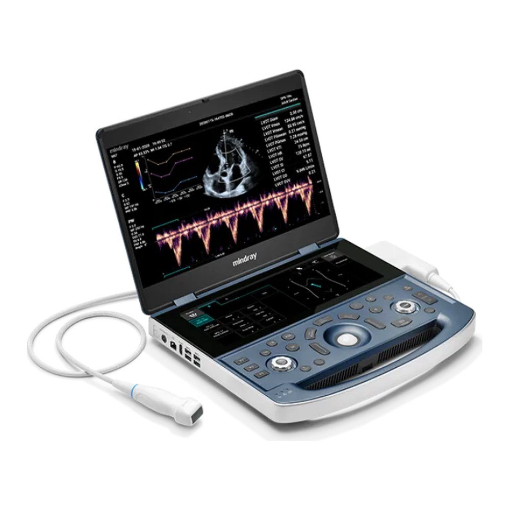 Ecógrafo portátil MX-7